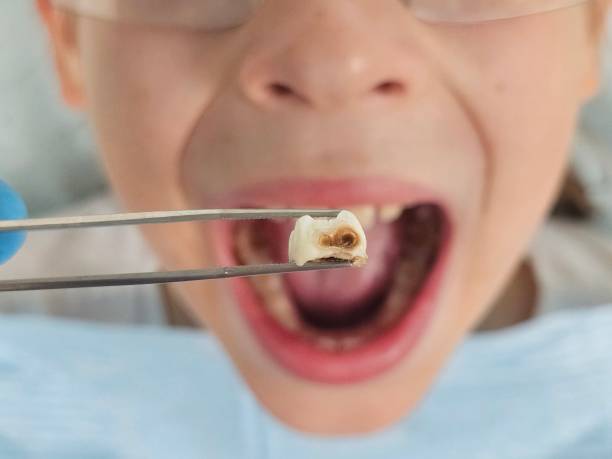 Best Weekend Emergency Dentist in West Siloam Springs, OK