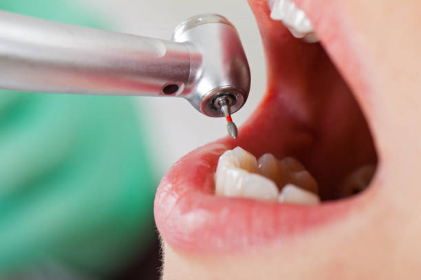 Best Orthodontic Emergency Dentist in West Siloam Springs, OK